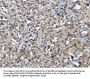 DDR2 Antibody