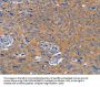 BOD1 Antibody