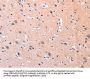 PTK2 Antibody