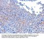 PTK2 Antibody