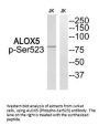 Phospho-ALOX5 (Ser523) Antibody