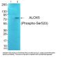 Phospho-ALOX5 (Ser523) Antibody