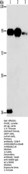PLA2G4B Antibody