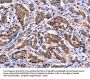 EIF2AK4 Antibody