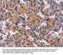 EIF2AK4 Antibody
