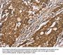 DICER1 Antibody