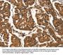 CTNNBIP1 Antibody