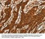 CTNNBIP1 Antibody