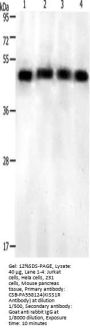 KISS1R Antibody