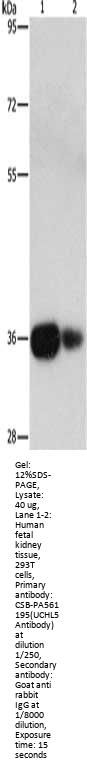 UCHL5 Antibody