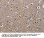 Rabbit anti-human KLHL2 polyclonal antibody