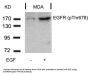 Phospho-EGFR (Thr678) Antibody