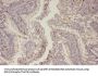 Phospho-EGFR (Thr678) Antibody