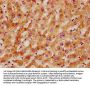 ACHE Antibody