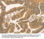 BCL2L14 Antibody