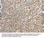 BCL2L14 Antibody