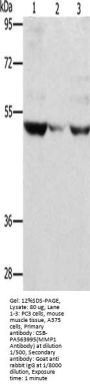 MMP1 Antibody