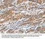 CAMK4 Antibody