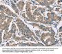 CAMK4 Antibody