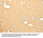 Rabbit anti-human SNAP25 polyclonal antibody