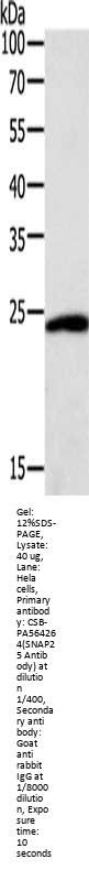 Rabbit anti-human SNAP25 polyclonal antibody
