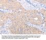 TRIM32 Antibody