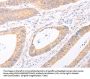 TRIM32 Antibody
