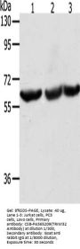 TRIM32 Antibody