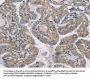 RAB21 Antibody