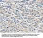 TRPM2 Antibody