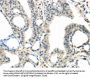 TRPM2 Antibody