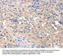 PRPS1/PRPS2/PRPS1L1 Antibody