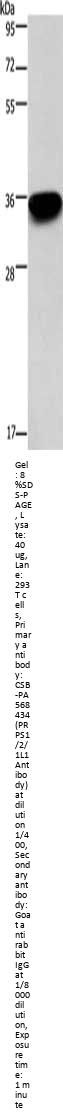 PRPS1/PRPS2/PRPS1L1 Antibody