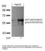 Phospho-AKT1/AKT2/AKT3 (Tyr315/316/312) Antibody