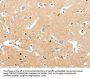SCN9A Antibody