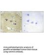 CAMKV Antibody