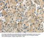 CLDN19 Antibody