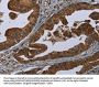 HOMER2 Antibody