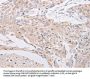 PIWIL1 Antibody