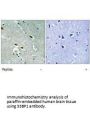 TP53BP1 Antibody
