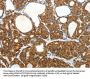 SLC12A4 Antibody