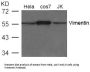 VIM Antibody