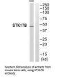 STK17B Antibody