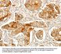 ACE Antibody