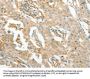 ACE Antibody