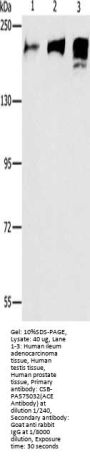ACE Antibody