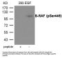 Phospho-BRAF (Ser446) Antibody