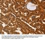 IKZF3 Antibody