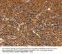 IKZF3 Antibody