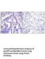 PIAS4 Antibody